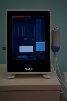 Nový přístroj pro měření poškození jaterní tkáně pomůže našim pacientům